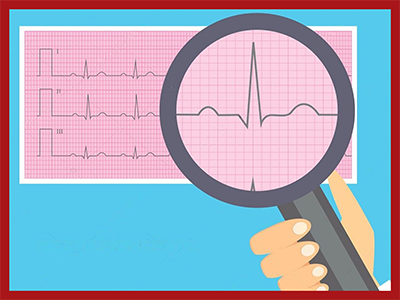 Basic interpretations of ECG